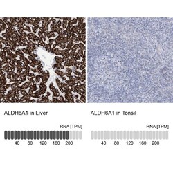 ALDH6A1 Antibody, Novus Biologicals:Antibodies:Primary Antibodies